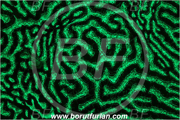 Pantar, Alor, Indonesia, Platygyra sp., Platygyra, Merulinidae, Coral, Brain coral, Anthozoa, Cnidaria, Cnidarian, Abstract, UV, UV illumination, UV light, Biofluorescence